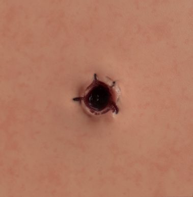 9mm Bullet Wound 1